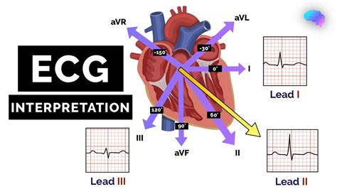 ecg for dummies